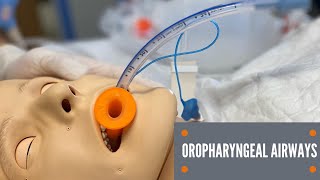 Oropharyngeal Airway Insertion [upl. by Akenor204]