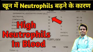 High Neutrophil Count in blood test  high neutrophils in blood  neutrophil count  neutrophils [upl. by Anihpesoj674]