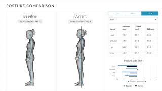 3D Body Scanning  Postural Assessment Software PAS  Fit3D [upl. by Ydok]