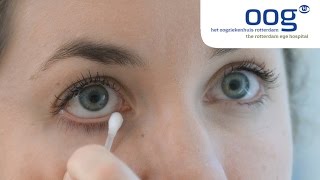 Reinigen en masseren van het ooglid bij blepharitis [upl. by Ezarra]