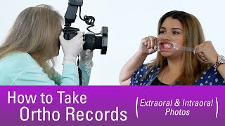 How to Take Orthodontic Records [upl. by Tannenbaum880]