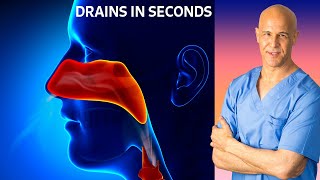 Dr Mandells Sinus Drainage Trick [upl. by Etnovad]