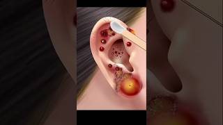 ASMR Ear cleaning animation 👂asmr animation skincare shorts viralshorts [upl. by Attenreb]