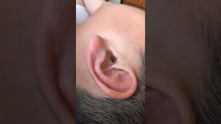 How to Use Hydrogen Peroxide To Remove Ear Wax [upl. by Ahseka]