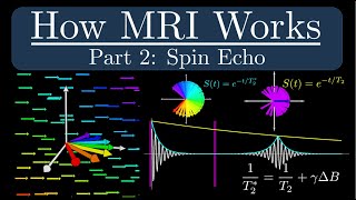 How MRI Works  Part 2  The Spin Echo [upl. by Eyssej]