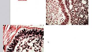 Odontogenic Tumors [upl. by Zapot]