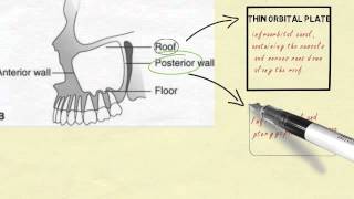 Anatomy of maxillary sinus [upl. by Enrica]