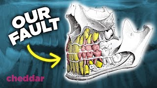 The Surprising Reason Why Human Teeth Are A Design Disaster  Cheddar Explains [upl. by Swanson]