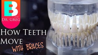 BRACES EXPLAINED How Teeth Move  Braces Work [upl. by Gudren]