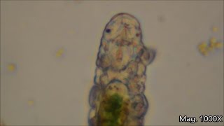 Water Bears under the microscope [upl. by Stig]