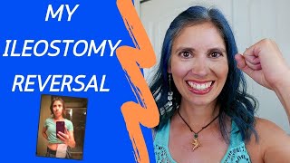 My Ileostomy Reversal Experience [upl. by Negyam413]