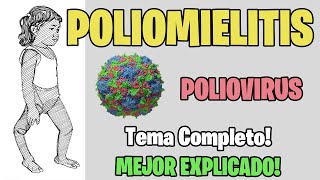 POLIO POLIOVIRUS POLIOMIELITIS 📚 [upl. by Dunseath]