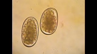 Hookworms in dogs  Ancylostoma caninum Flotation method [upl. by Aihseyk579]