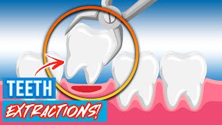 Tooth Extractions For Braces  Why Do Orthodontists Extract Teeth [upl. by Silverman558]