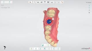 3Shape TRIOS Implant restoration workflow IT [upl. by Egiap505]