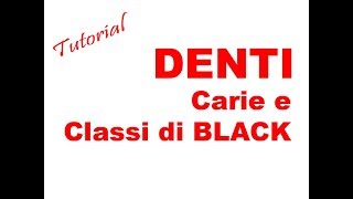 METASALUTE tutorial DENTI  carie e classi di black [upl. by Eihcir]