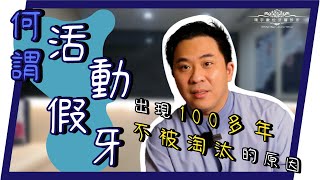 【何謂活動假牙？】不用手術也可以擁有美美好用的牙齒？！CP值超高！＃活動假牙 ＃全口活動假牙 ＃局部活動假牙 ＃假牙保養 ＃假牙選擇＃RPD 環宇數位牙醫診所 [upl. by Jarlathus]