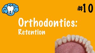 Orthodontics  Retention  INBDE ADAT [upl. by Lledo]