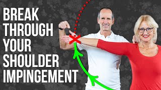 Shoulder Impingement Causes and Treatment [upl. by Enaht]