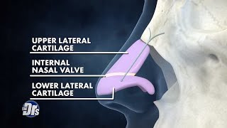 LATERA Animation for Patients with Nasal Congestion [upl. by Caresa527]